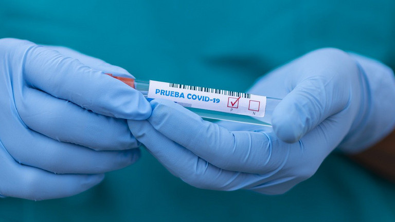 Zwei Hände halten eine Covid19-Probe.